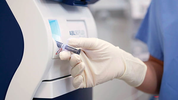 Homogeneização automática no analisador ABL90 FLEX PLUS